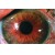 Сухость в глазах - причины, лечение, капли при сухом глазе, народные методы лечения