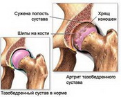Сустав Сустав