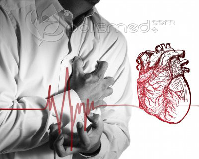 Как отличить инфаркт от стенокардии
