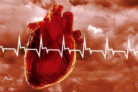 Все факты о тахикардии - что это такое и как лечить сердце