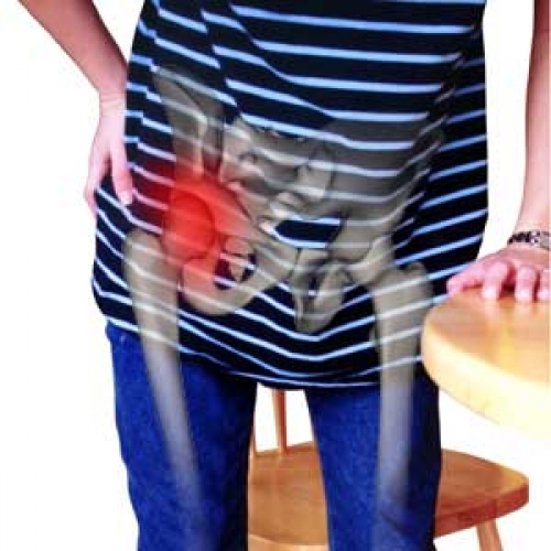 Лечение коксартроза тазобедренного сустава в СПб: симптомы и лечение артроза суставов в клинике «Мастерская Здоровья»