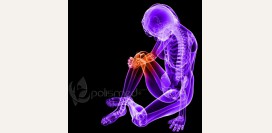 Артроз суставов - симптомы, стадии, современная диагностика и методы эффективного лечения