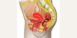 Кольпит - причины, симптомы и признаки, диагностика и лечение болезни