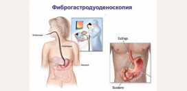 Фиброгастродуоденоскопия (ФГДС). Что такое ФГДС, показания, какие болезни выявляет