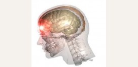 Ушиб головного мозга - симптомы, признаки, первая помощь, степени повреждения