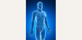 Паховая грыжа. Причины, симптомы, диагностика и лечение