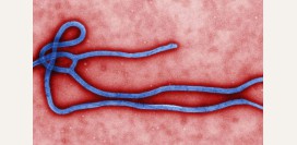 Лихорадка Эбола. Симптомы, диагностика, анализы и прививка от болезни