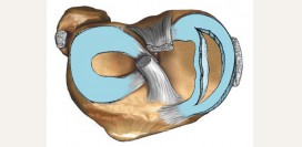 Разрыв и повреждение мениска. Причины, симптомы, первая медицинская помощь и реабилитация