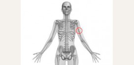 Перелом плечевой кости. Причины, симптомы, виды, первая медицинская помощь и реабилитация