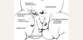 Крипторхизм. Причины, симптомы, диагностика и лечение