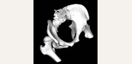 Вывих бедренного сустава (бедра). Причины, симптомы, виды, первая медицинская помощь и реабилитация