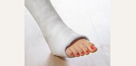 Перелом лодыжки. Причины, симптомы, виды, первая медицинская помощь и реабилитация