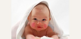 Атопический дерматит у детей. Причины, симптомы, признаки, диагностика и лечение патологии