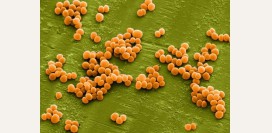 Стафилококк. Обнаружен стафилококк в носу, горле, зеве, на коже, что делать? Золотистый стафилококк у грудных детей. Как выявить и лечить инфекцию?