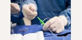 Стентирование сонных артерий может быть опасным для пожилых пациентов 