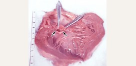 Кардиосклероз. Причины, симптомы, признаки, диагностика и лечение патологии