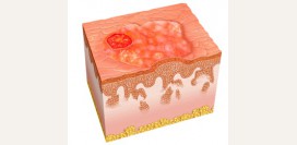 Плоскоклеточный рак. Причины, симптомы, признаки, диагностика и лечение патологии