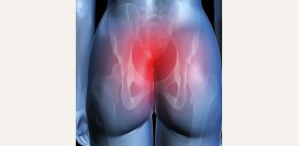 Боль в копчике. Причины, симптомы, виды, лечение и реабилитация