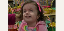 Синдром Эдвардса (трисомия 18). Причины, симптомы, признаки, диагностика и лечение патологии