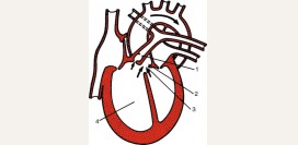 Легочное сердце. Причины, симптомы, признаки, диагностика и лечение патологии