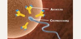 Антиспермальные антитела. Выявление антител в цервикальной слизи, показания к исследованию, методы проведения, результаты