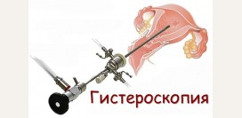 Гистероскопия. Диагностическая гистероскопия при бесплодии, показания, противопоказания
