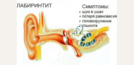 Лабиринтит (внутренний отит). Причины, симптомы, признаки, диагностика и лечение патологии