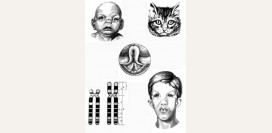 Синдром кошачьего крика. Причины, симптомы, признаки, диагностика и лечение патологии