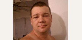 Почечные отеки. Причины, симптомы, признаки, диагностика и лечение патологии