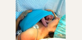 Кесарево сечение. Показания, противопоказания, осложнения