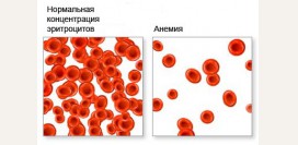 Фолиеводефицитная анемия. Причины, симптомы, диагностика и лечение патологии