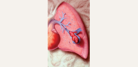 Тромбоэмболия легочной артерии. Причины, симптомы, признаки, диагностика и лечение патологии.