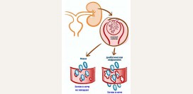 Нефротический синдром. Причины, симптомы, признаки, диагностика и лечение патологии