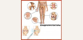 Хондропротекторы. Поколения, сравнение, как применять при болезнях суставов