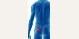 Боли в ягодице. Причины болей в ягодице. Что делать при этих болях?