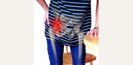 Коксартроз (артроз тазобедренного сустава). Причины, симптомы, диагностика и лечение артроза