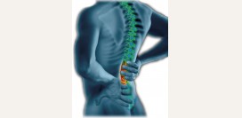 Болит спина - анатомия спины, причины возникновения болей