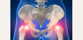 Болит бедро. Помощь при болях в правом и левом бедре. Лечение причин возникновения болей. Особенности болей в бедре