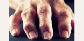 Болят суставы пальцев рук - причины, виды болей и патологии, вызывающие болезненность