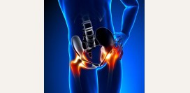 Боли в тазобедренном суставе. Причины, виды болей, патологии, вызывающие болезненность, помощь при болях