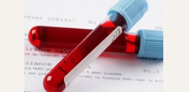 Анализ крови на АКТГ (адренокортикотропный гормон). Признаки повышения и снижения гормона, норма по возрасту, методика определения. Как подготовится к тесту?