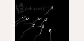 Спермограмма - объем, цвет, время разжижения, кислотность, активность сперматозоидов. Расшифровка спермограммы, норма и патология