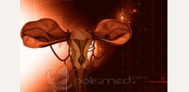 Эндометриоз - причины, симптомы, современная диагностика, эффективное лечение болезни