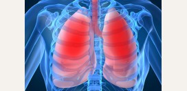 Пневмония - причины, симптомы, современная диагностика и лечение болезни