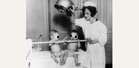 Рахит - причины заболевания, диагностика и лечение