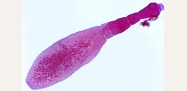 Эхинококкоз - причины, симптомы, современная диагностика и эффективное лечение