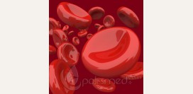 Анемия. Виды анемий: железодефицитная, гемолитическая, В12 дефицитная, апластическая.  Причины, диагностика, степени анемии.