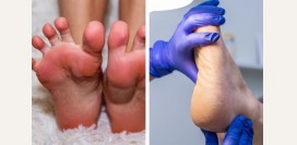 Подолог. Чем занимается данный специалист, какие исследования производит, какие патологии лечит?