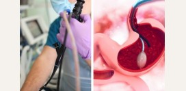 Эндоскопист. Чем занимается данный специалист, какие исследования производит, какие патологии лечит?