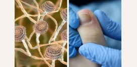 Миколог. Чем занимается данный специалист, какие исследования проводит, какие патологии лечит?